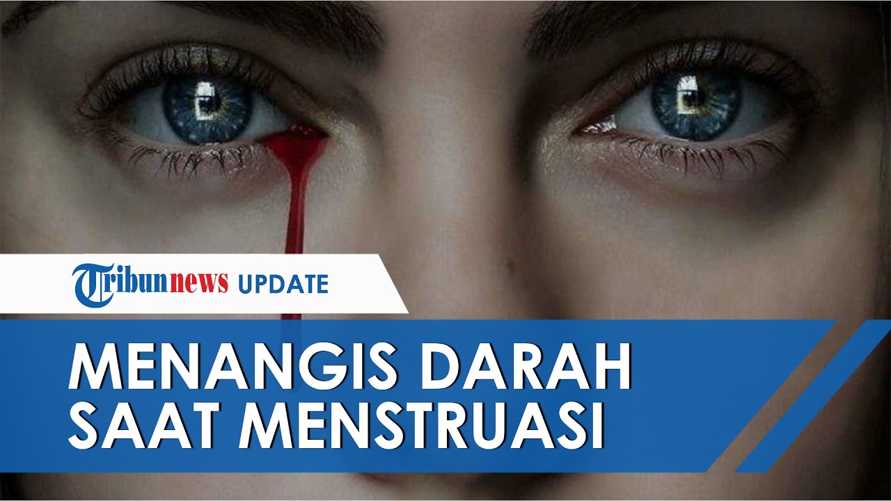 Detail Foto Mata Menangis Darah Nomer 23