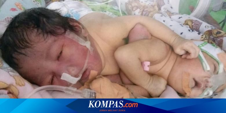 Detail Foto Melahirkan Bayi Kembar Nomer 16