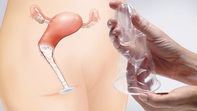Detail Foto Model Kondom Nomer 8