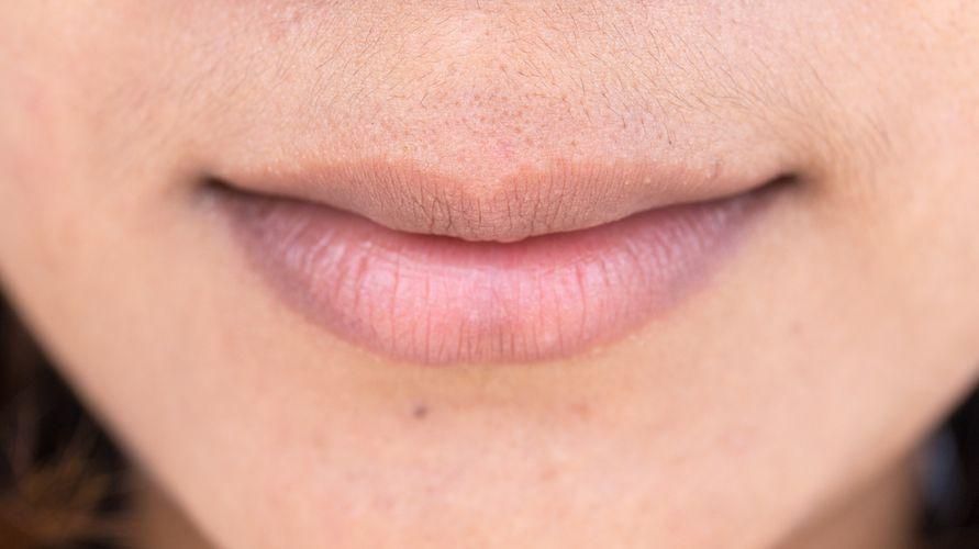 Detail Bintik Bintik Di Bibir Nomer 2