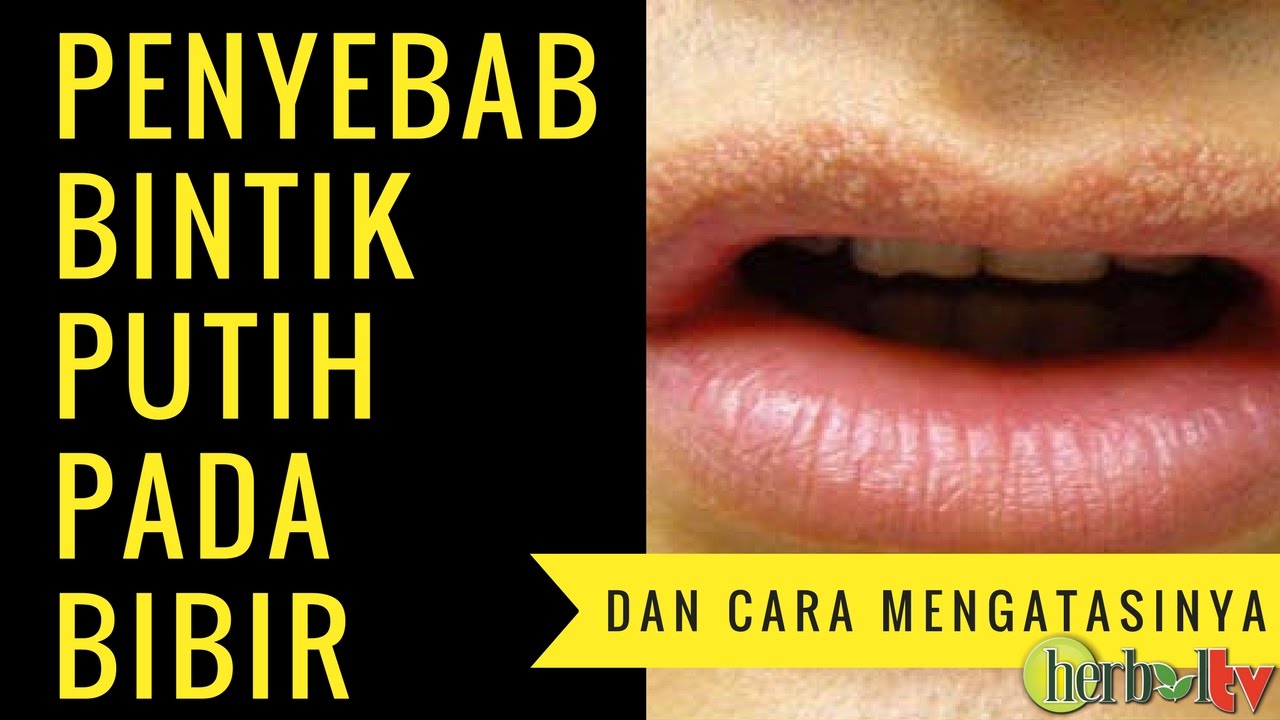 Detail Bintik Bintik Di Bibir Nomer 13