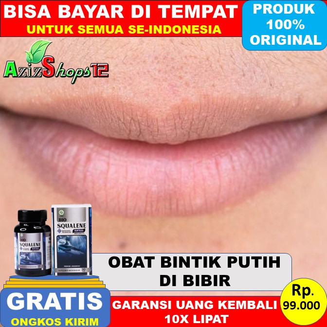 Detail Bintik Bintik Di Bibir Nomer 35