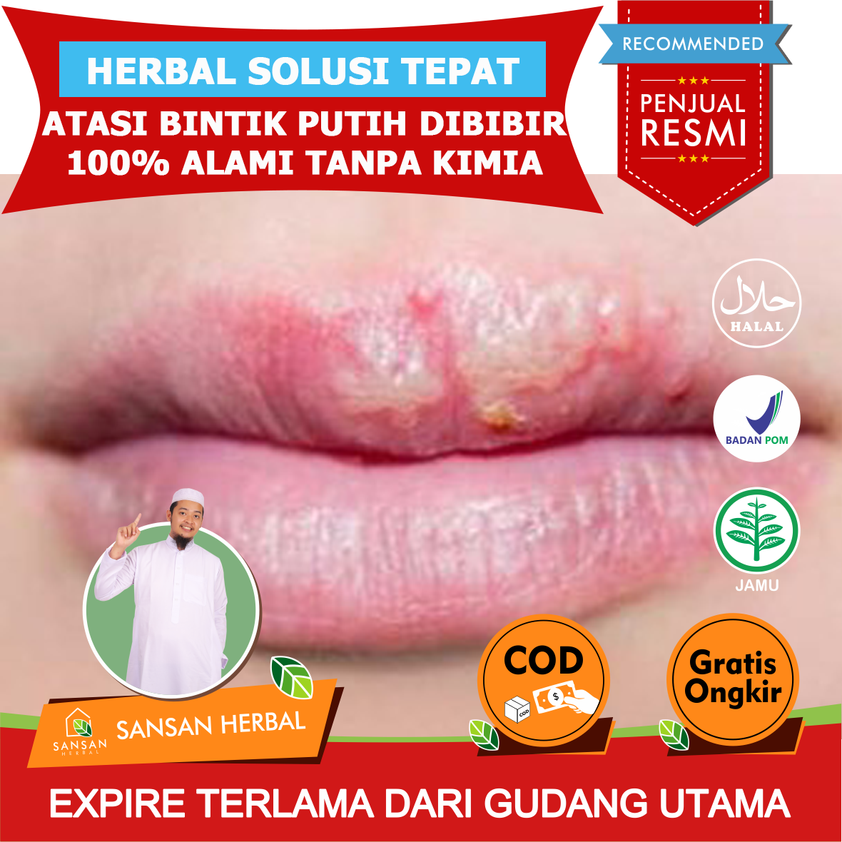 Detail Bintik Bintik Di Bibir Nomer 49