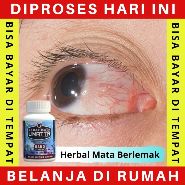 Detail Bintik Kuning Di Mata Nomer 20