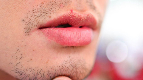 Detail Bintik Merah Di Bibir Nomer 2