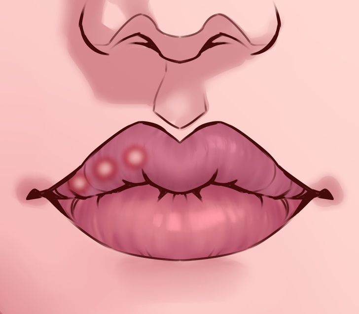 Detail Bintik Merah Di Bibir Nomer 25