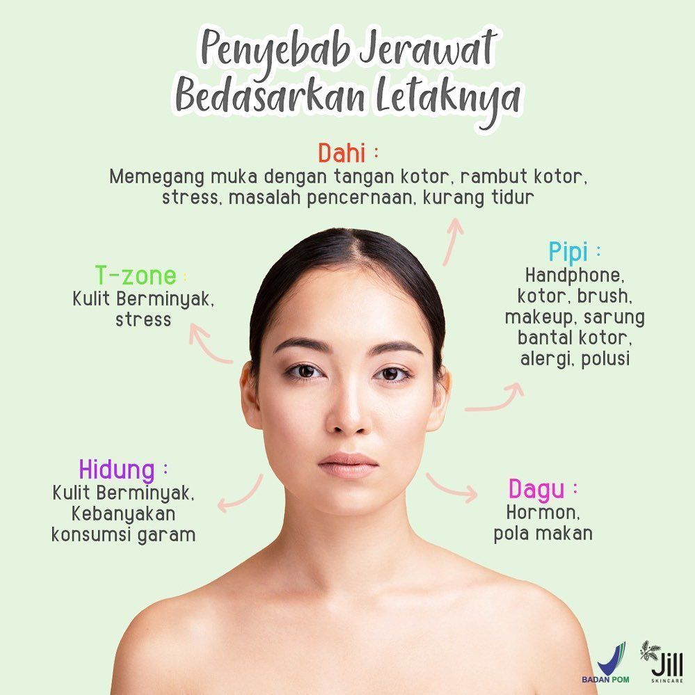 Detail Foto Muka Jerawatan Nomer 35