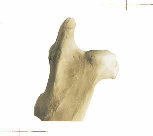 Detail Hervorstehender Knochen Am Knie Nomer 11