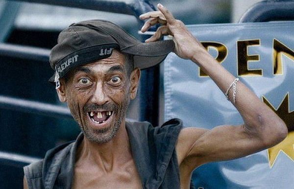 Detail Foto Orang Gilak Nomer 29