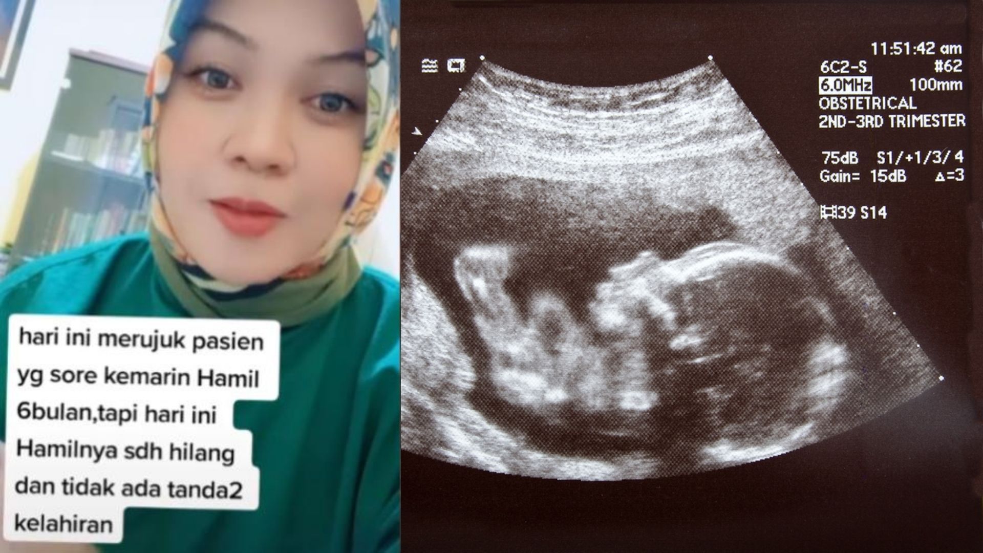 Detail Foto Orang Hamil 3 Bulan Nomer 45