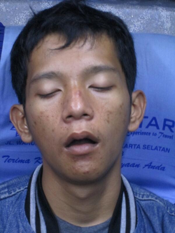 Detail Foto Orang Mangap Nomer 11