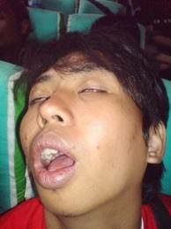 Detail Foto Orang Mangap Nomer 13