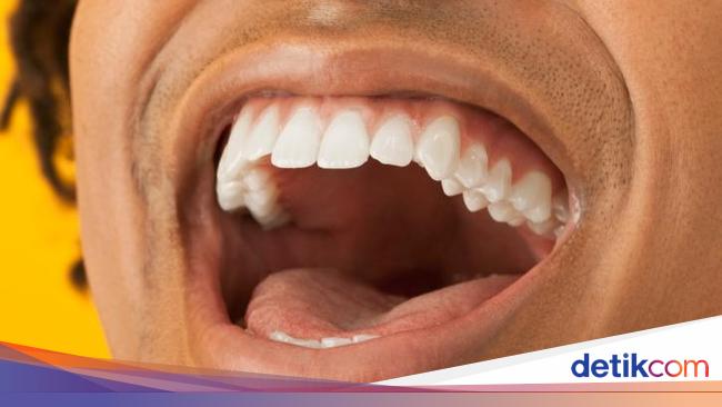 Detail Foto Orang Mangap Nomer 3