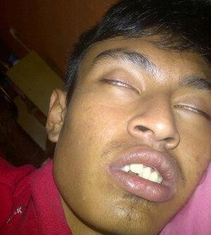 Detail Foto Orang Mangap Nomer 21