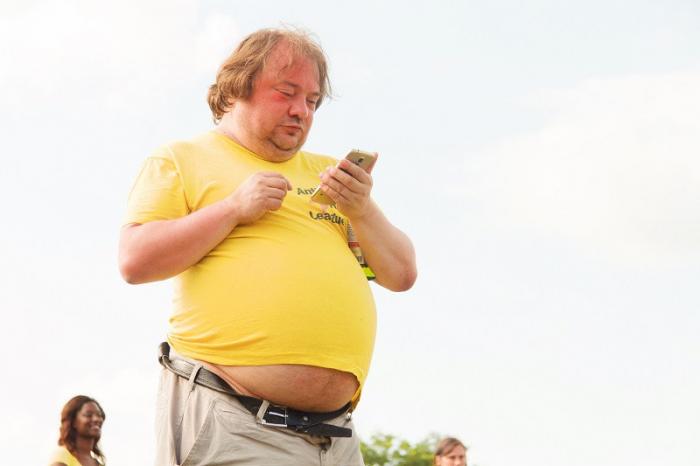 Detail Foto Orang Obesitas Nomer 24