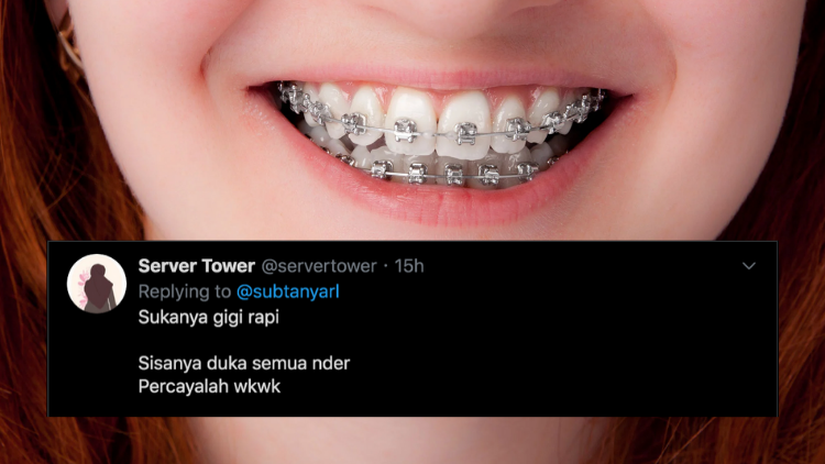 Detail Foto Orang Pake Behel Nomer 2
