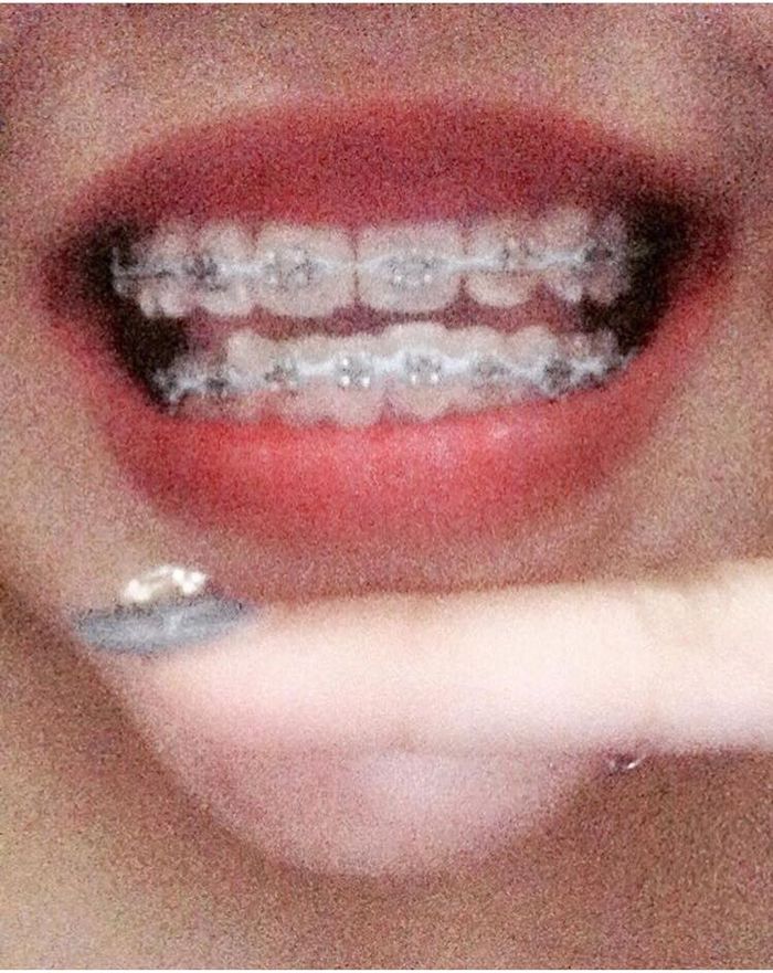 Detail Foto Orang Pake Behel Nomer 21