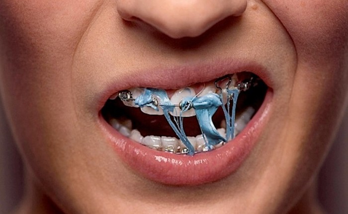Detail Foto Orang Pake Behel Nomer 25