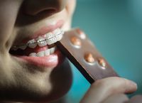 Detail Foto Orang Pake Behel Nomer 26
