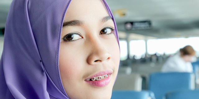 Detail Foto Orang Pake Behel Nomer 37
