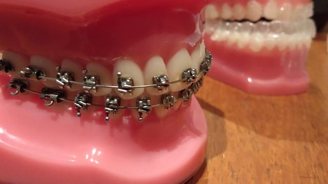 Detail Foto Orang Pake Behel Nomer 40