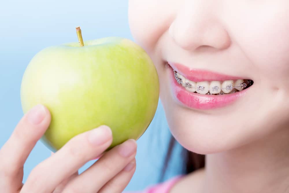 Detail Foto Orang Pake Behel Nomer 42
