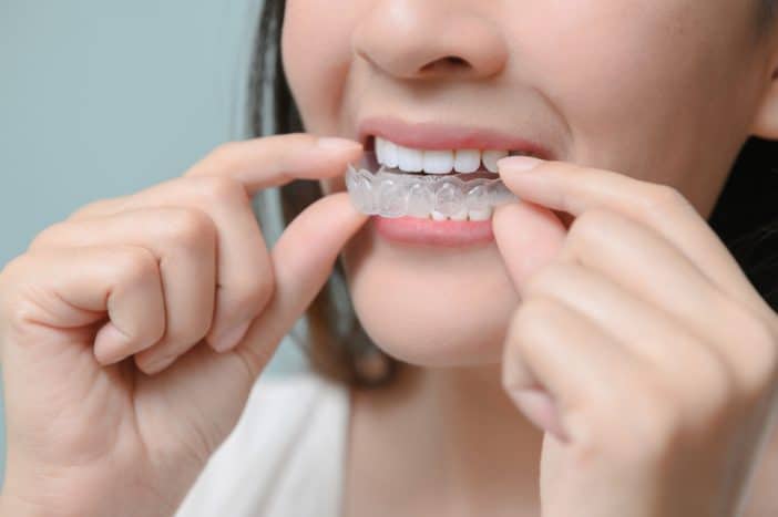 Detail Foto Orang Pake Behel Nomer 43