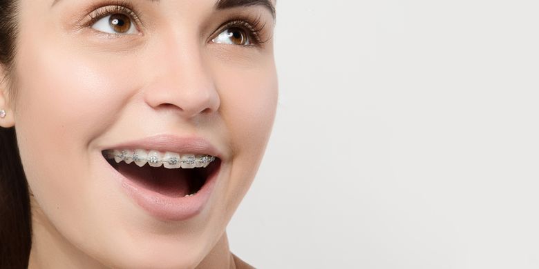 Detail Foto Orang Pake Behel Nomer 46