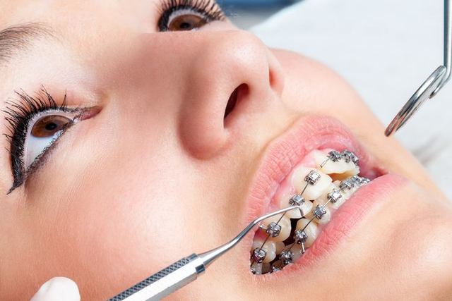 Detail Foto Orang Pake Behel Nomer 50