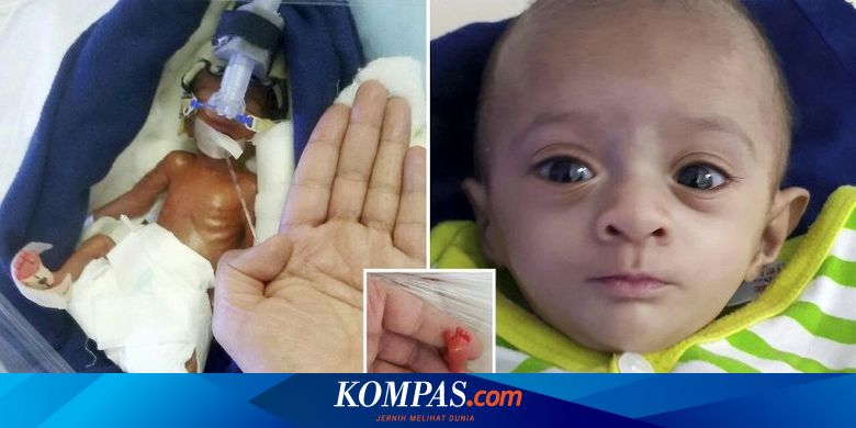 Detail Foto Orang Terkecil Di Dunia Nomer 35