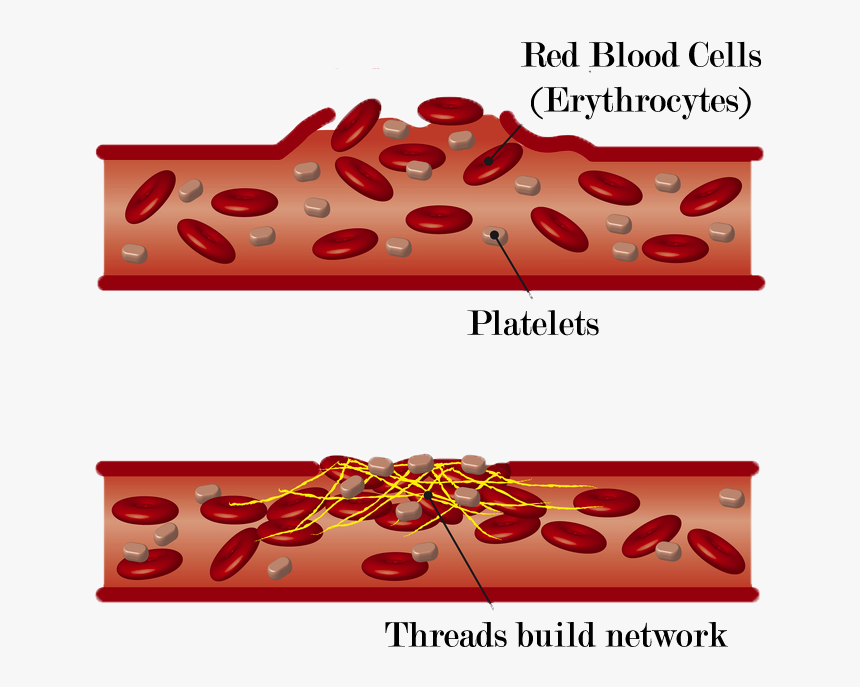 Detail Blood Cut Png Nomer 34