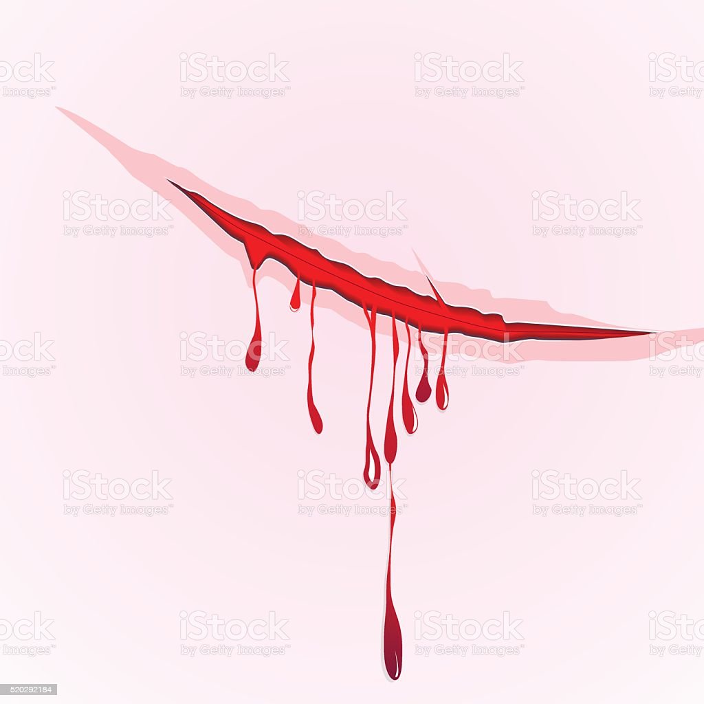 Detail Blood Scratch Png Nomer 37