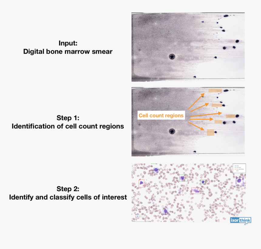 Detail Blood Smear Png Nomer 33