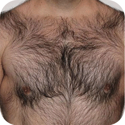 Detail Body Hair Png Nomer 33