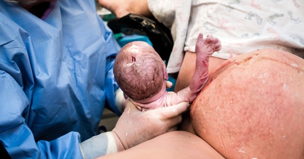 Detail Foto Proses Melahirkan Bayi Kembar Nomer 26