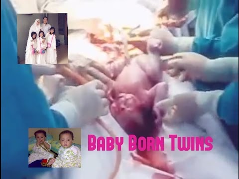 Detail Foto Proses Melahirkan Bayi Kembar Nomer 33