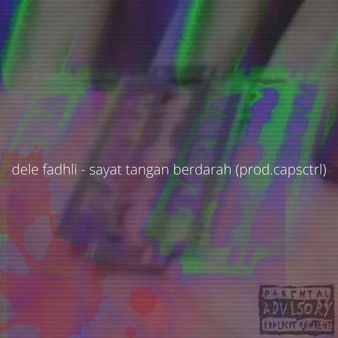 Detail Foto Sayat Tangan Nomer 39