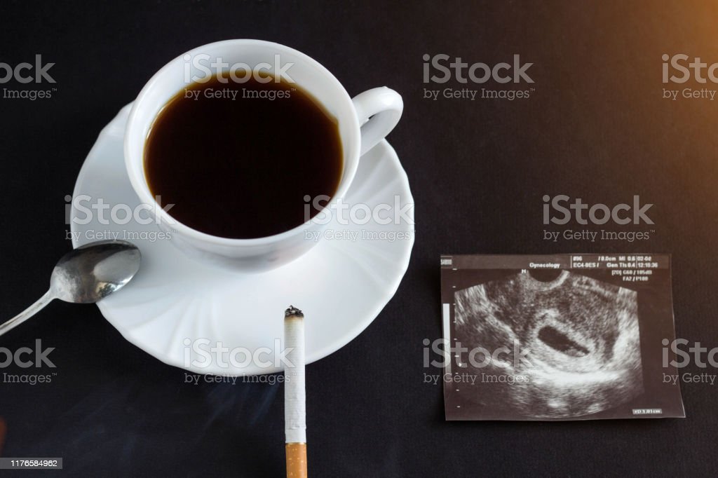 Detail Foto Segelas Kopi Dan Rokok Nomer 42