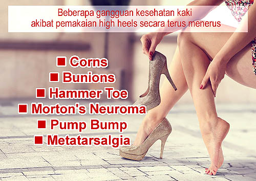 Detail Foto Sepatu Tinggi Cantik Nomer 58