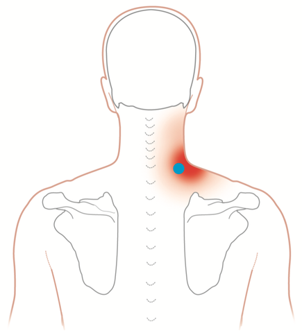 Detail Musculus Semispinalis Capitis Nomer 17