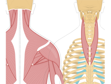 Detail Musculus Semispinalis Capitis Nomer 4