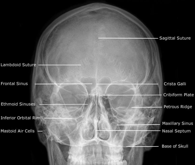 Foto Skull Radiologi - KibrisPDR