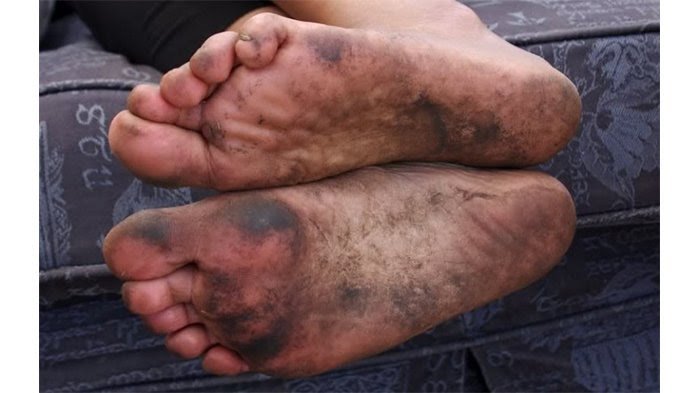 Detail Foto Telapak Kaki Wanita Nomer 35