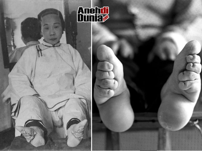 Detail Foto Telapak Kaki Wanita Nomer 45