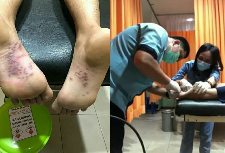 Detail Foto Telapak Kaki Wanita Nomer 48