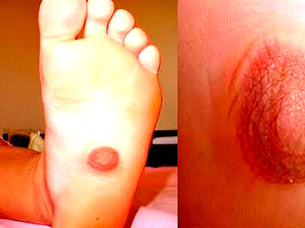 Detail Foto Telapak Kaki Wanita Nomer 51