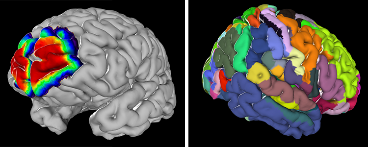 Detail Brains Png Nomer 48