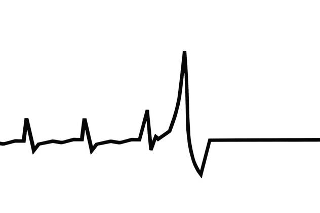 Nulllinie Ekg - KibrisPDR