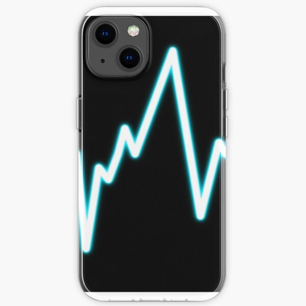 Detail Nulllinie Ekg Nomer 8