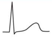 Detail Nulllinie Ekg Nomer 10